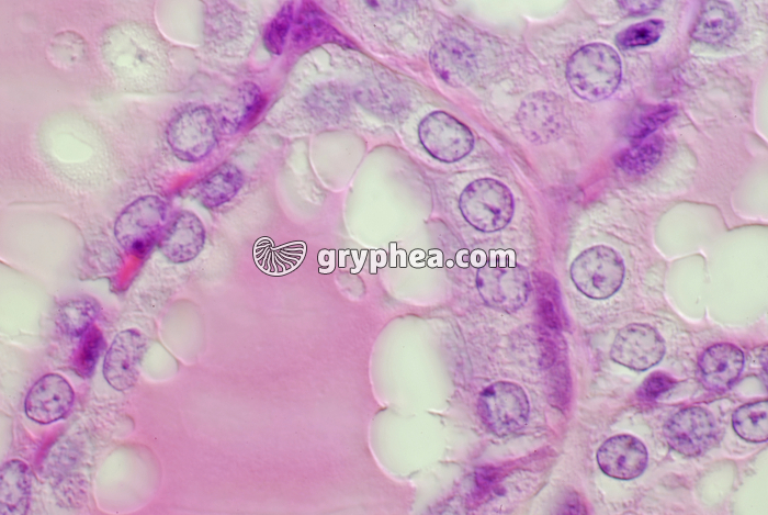 Thyroïde x400 - gryphea.com